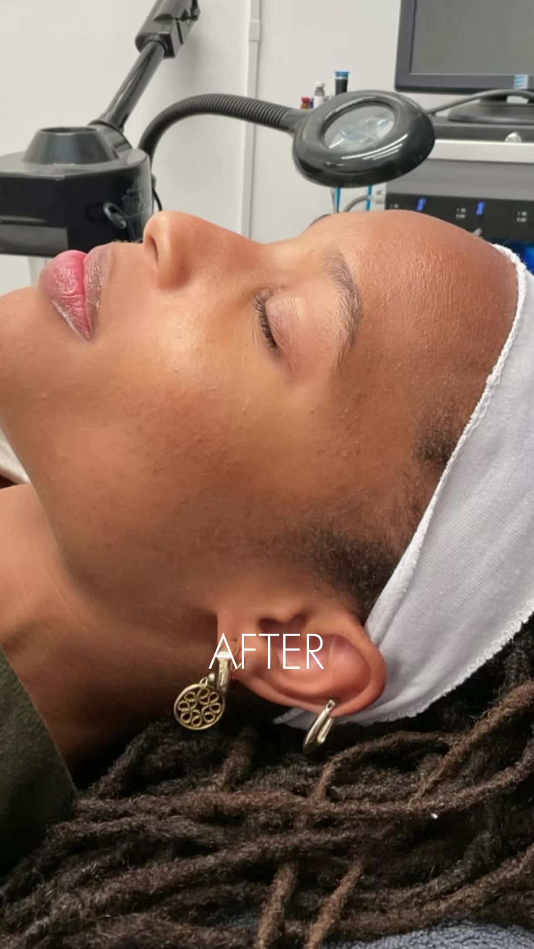 @Rosedermnyc