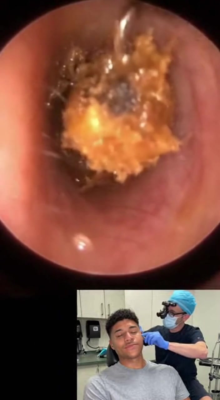 @Ear Cleaning