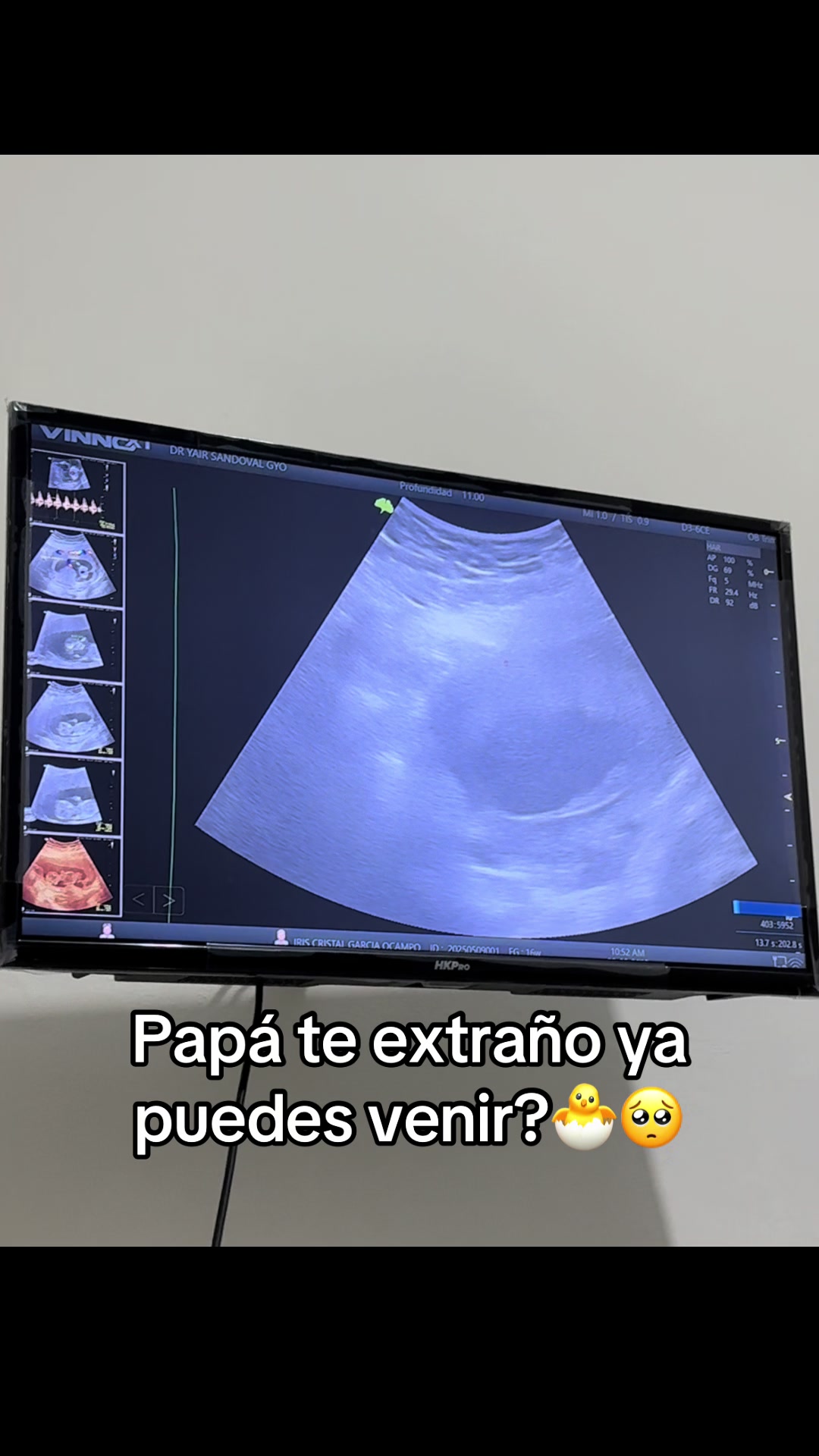 @Iris Cristal Garc&iacute;a Ocampo