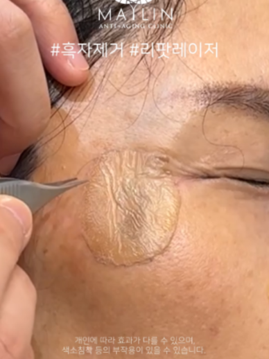 @메이린의원대구점