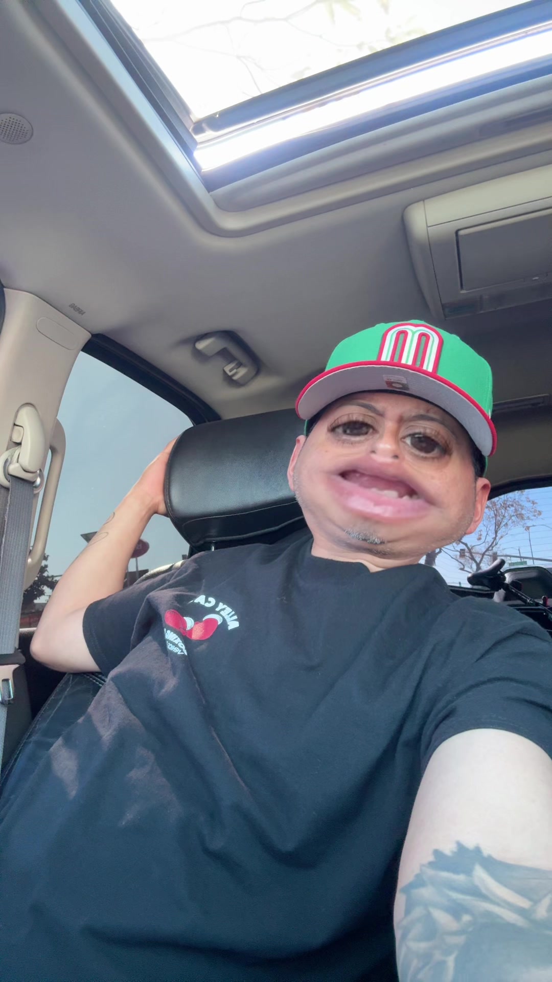 @MP