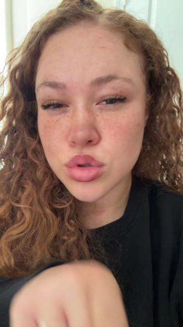 @gingervitus777