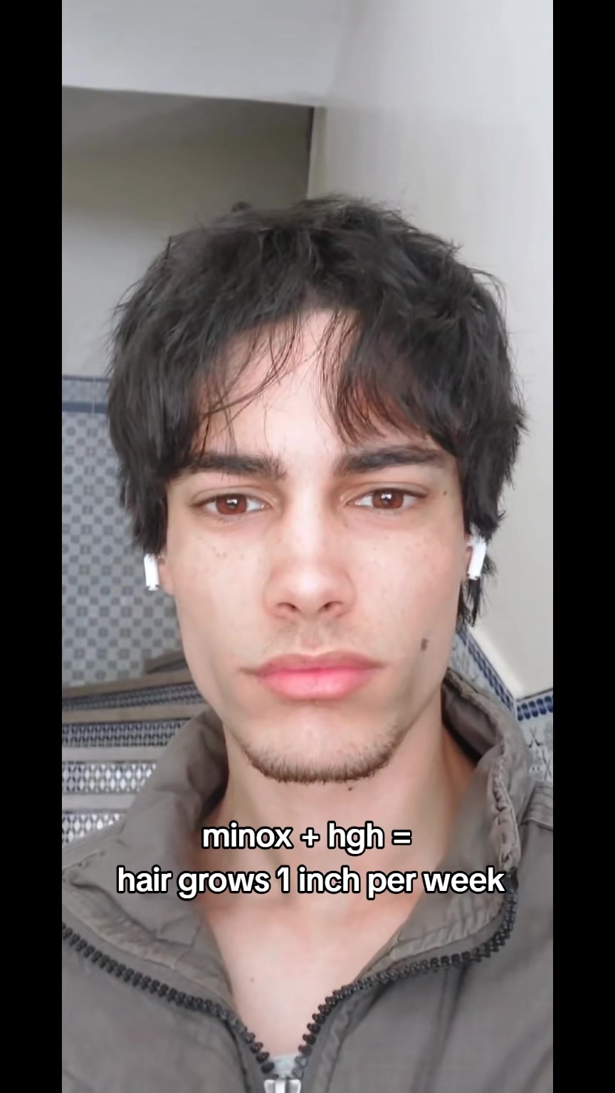@Imad Skywalker