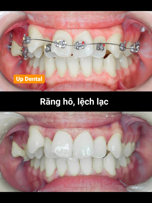 @Nha khoa niềng răng Up Dental