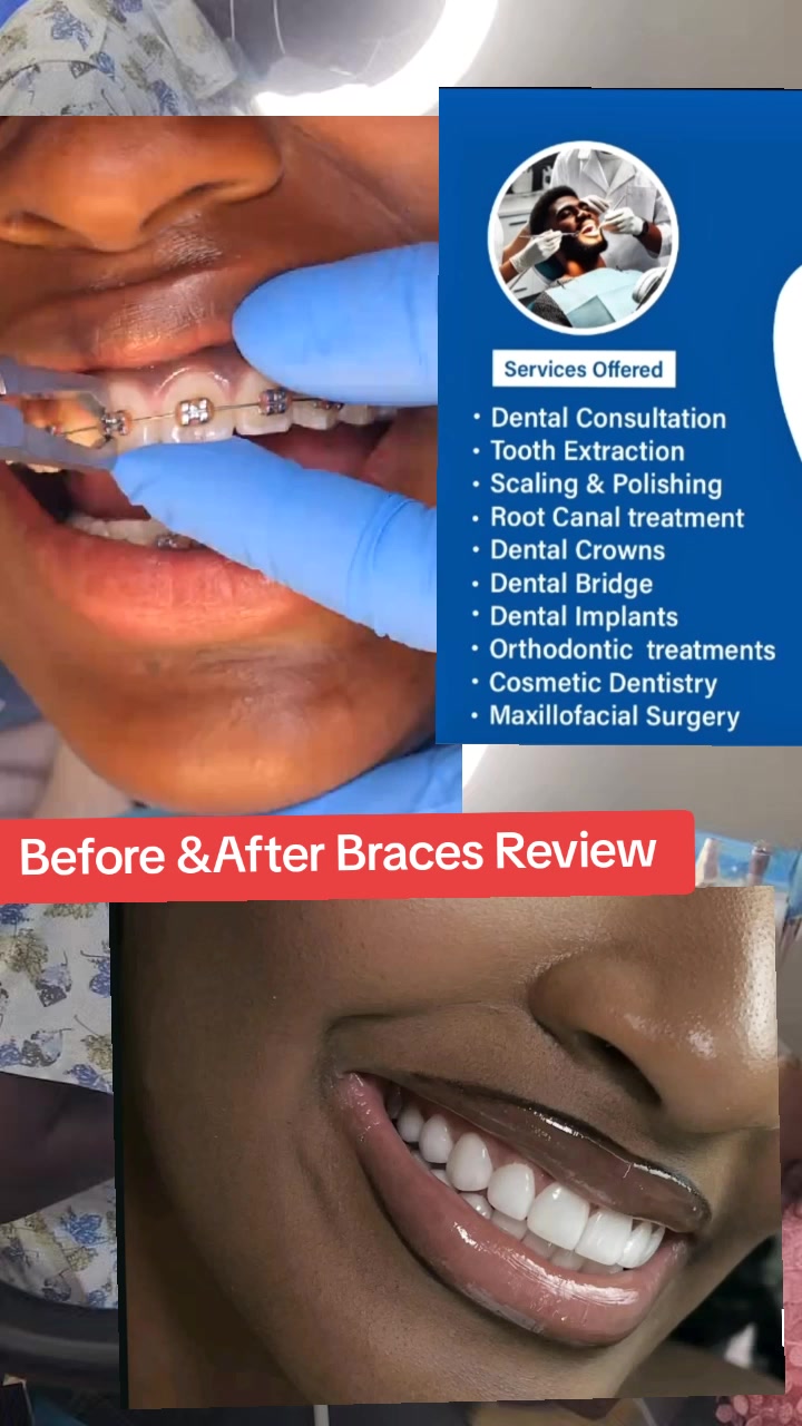 @Allianz Dental studio🦷🦷🇺🇬