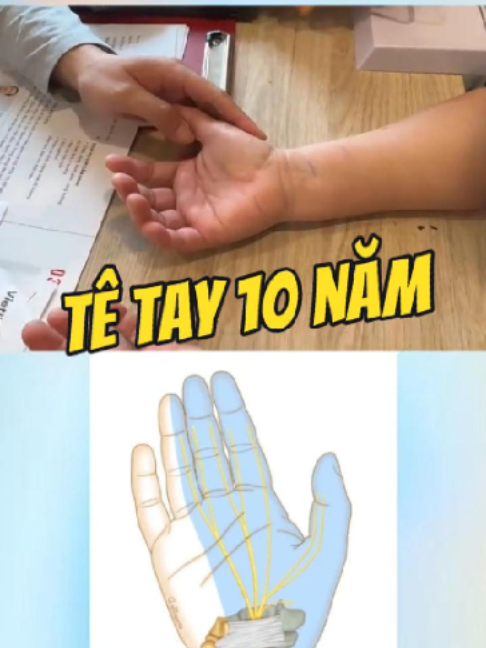 @Chuyên gia xương khớp