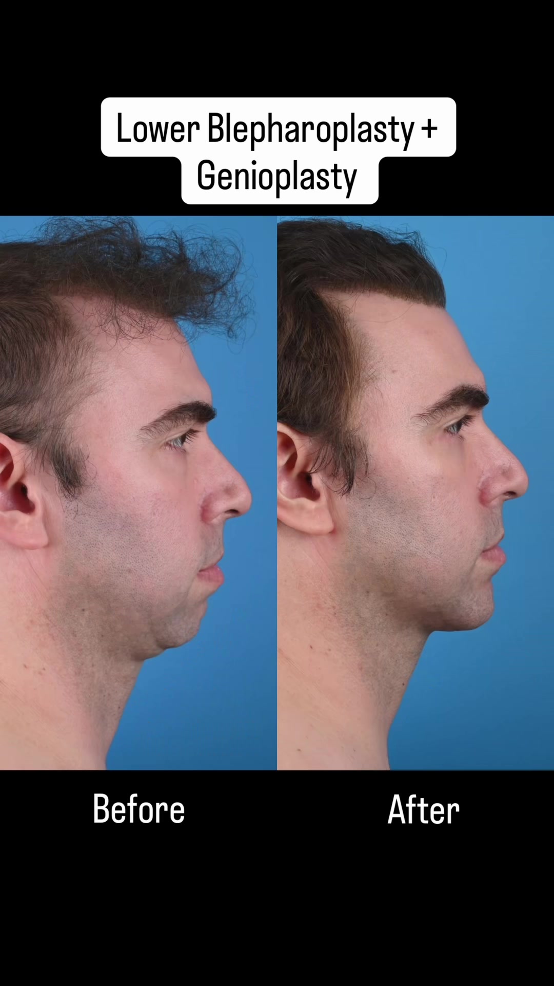 @Dr. Parit Patel, MD
