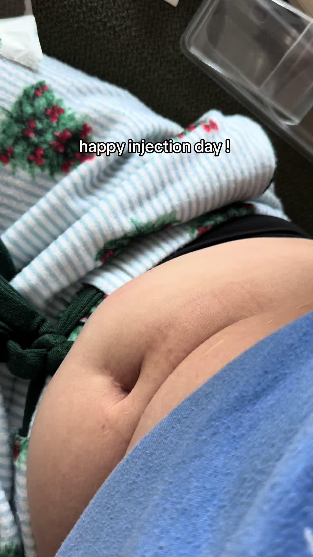 @KK’s lupus journey!