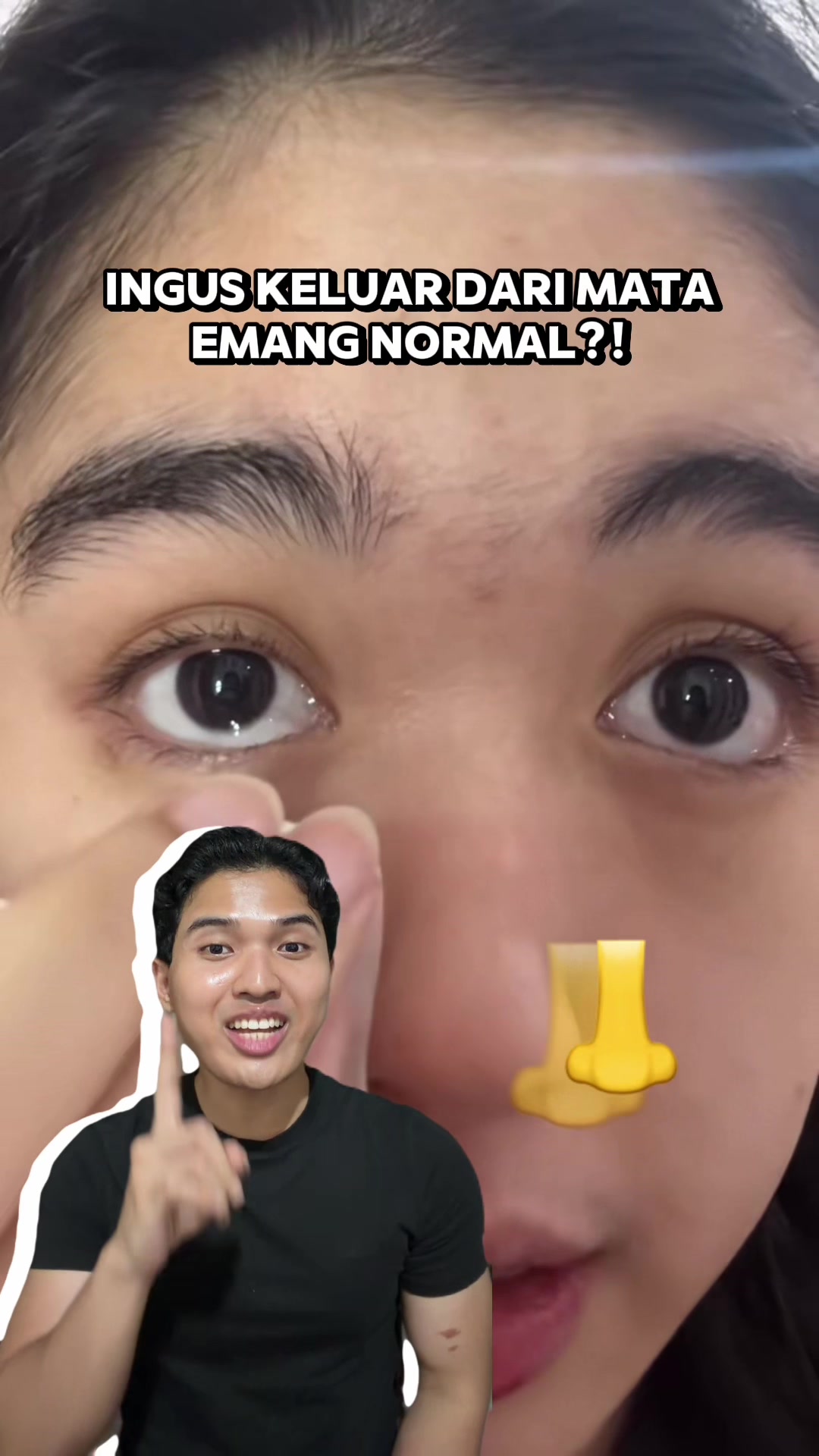 @Ekida