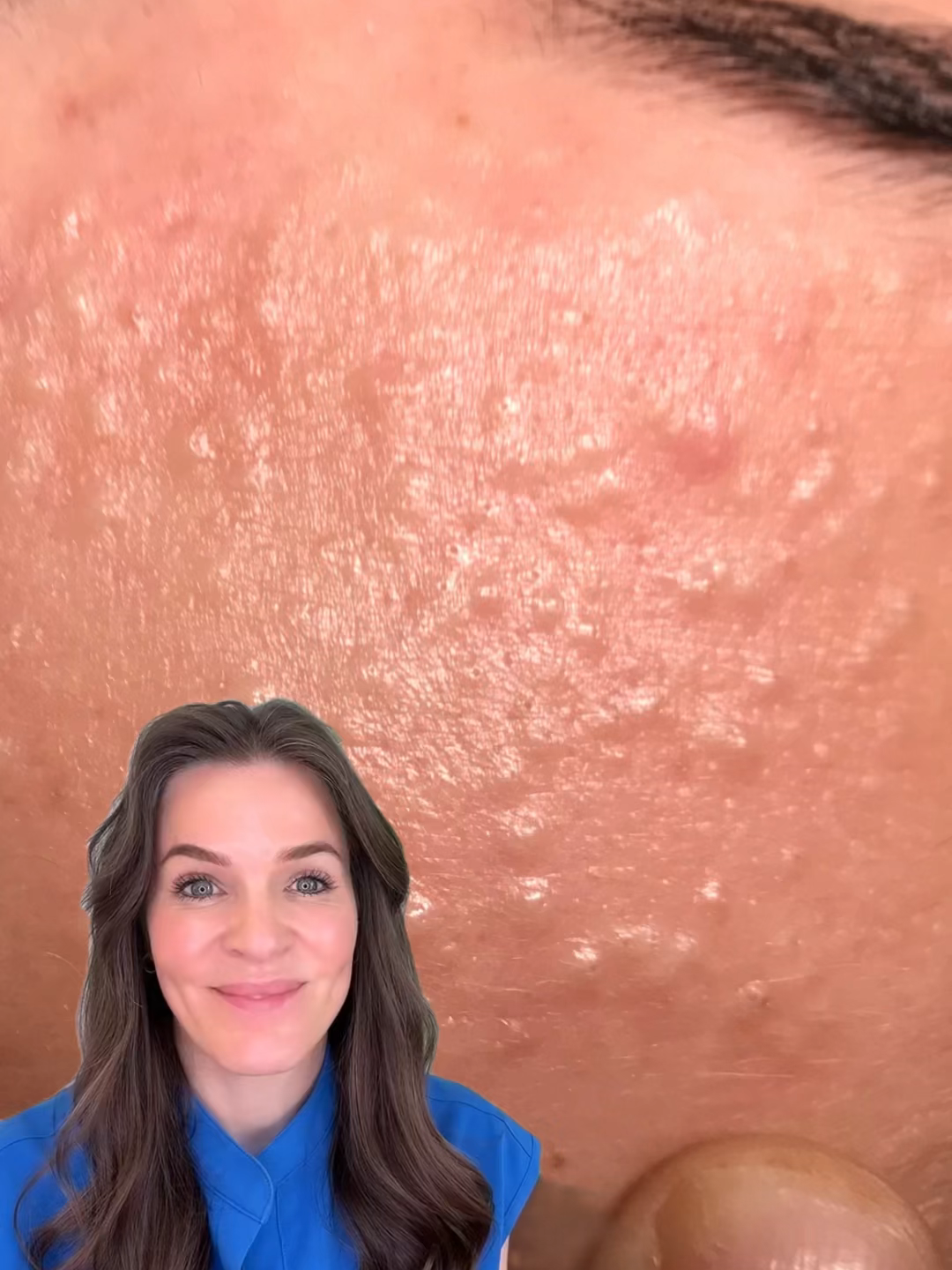 @Skin Plus Acne Clinic ATX