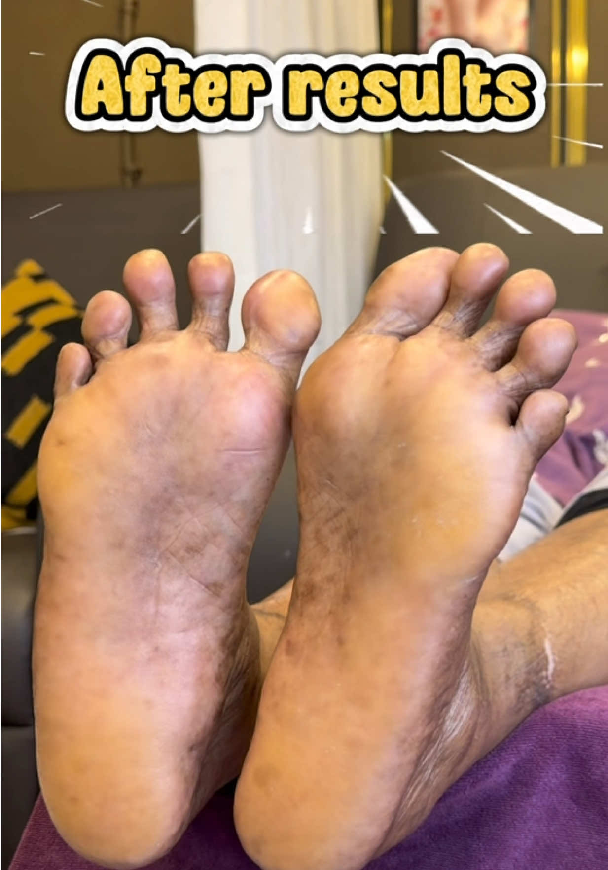 @LotusbeautyKlangSentosa