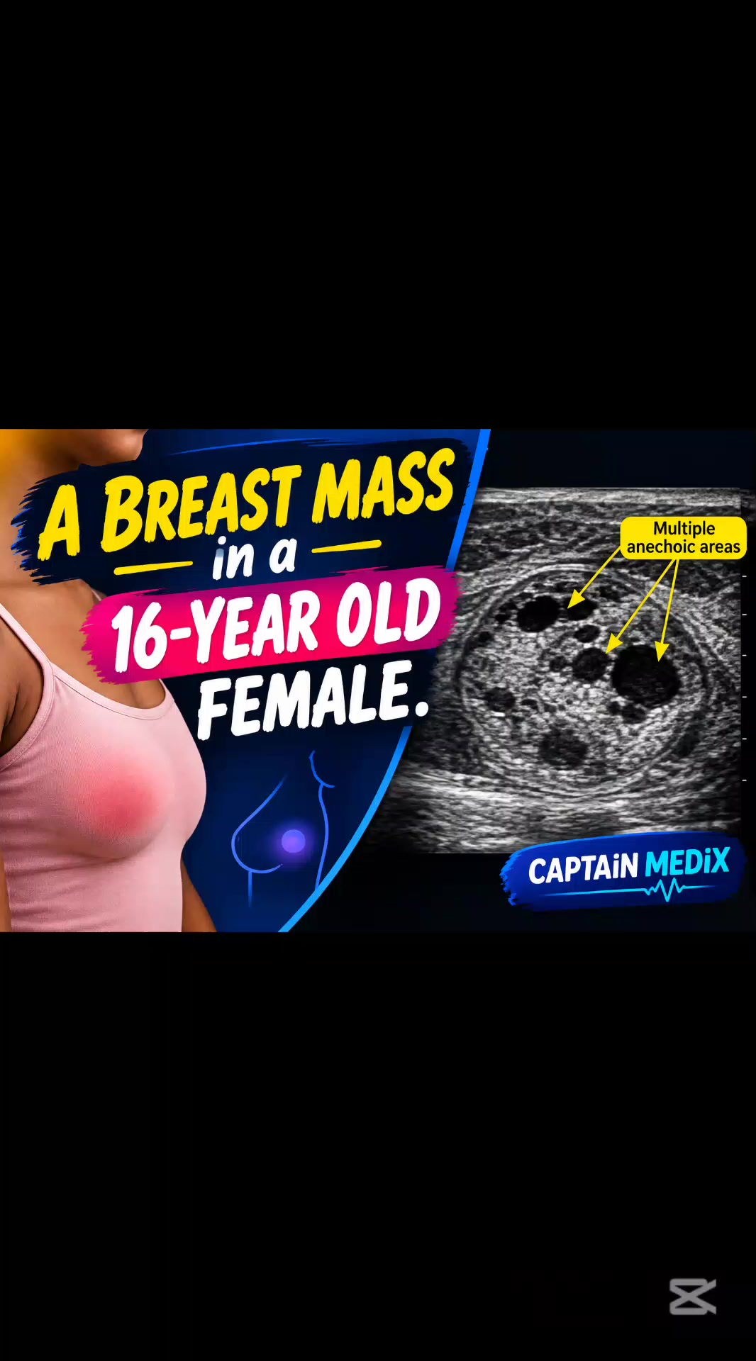 @CAPTAIN MEDiX