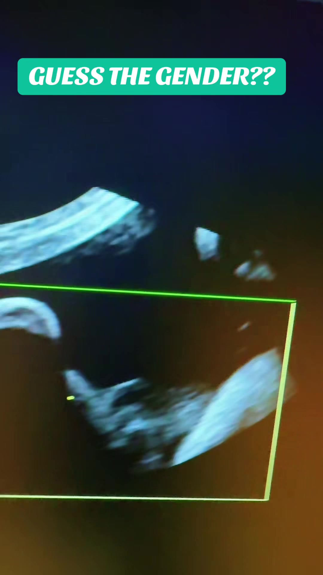 @PregnantSee Inc.