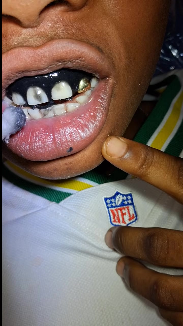 @Djoballa le dentiste
