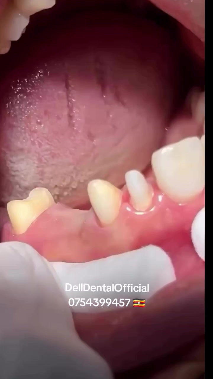 @DellDentalOfficial