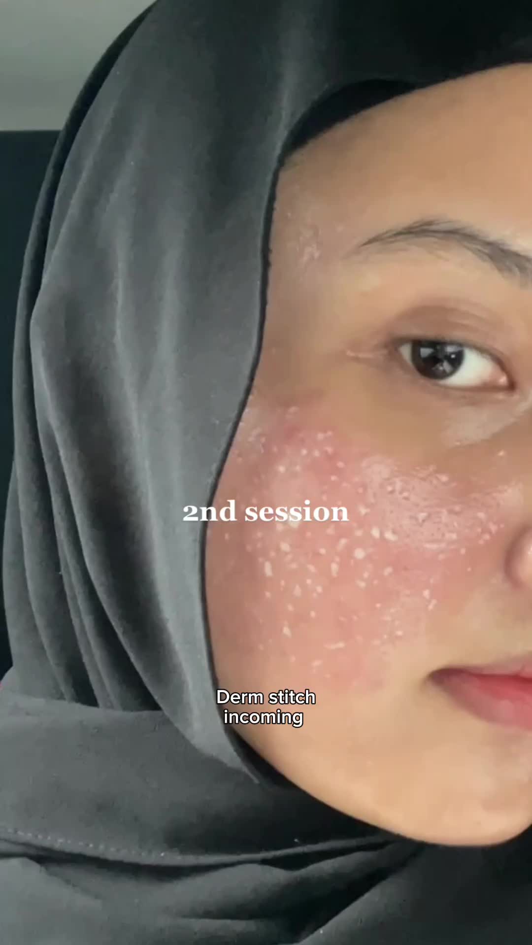 @Dr. Scott Walter | Derm