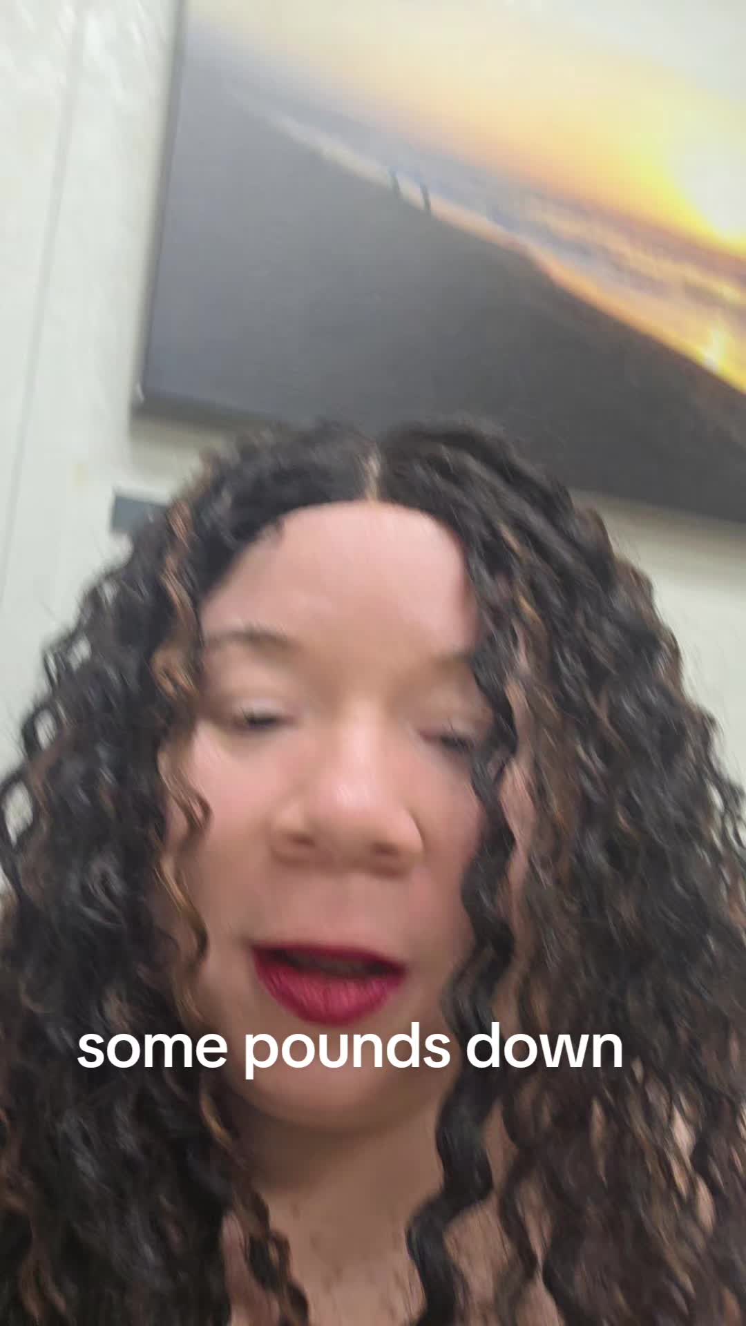 @Miss. PinkY(vitiligo girl)