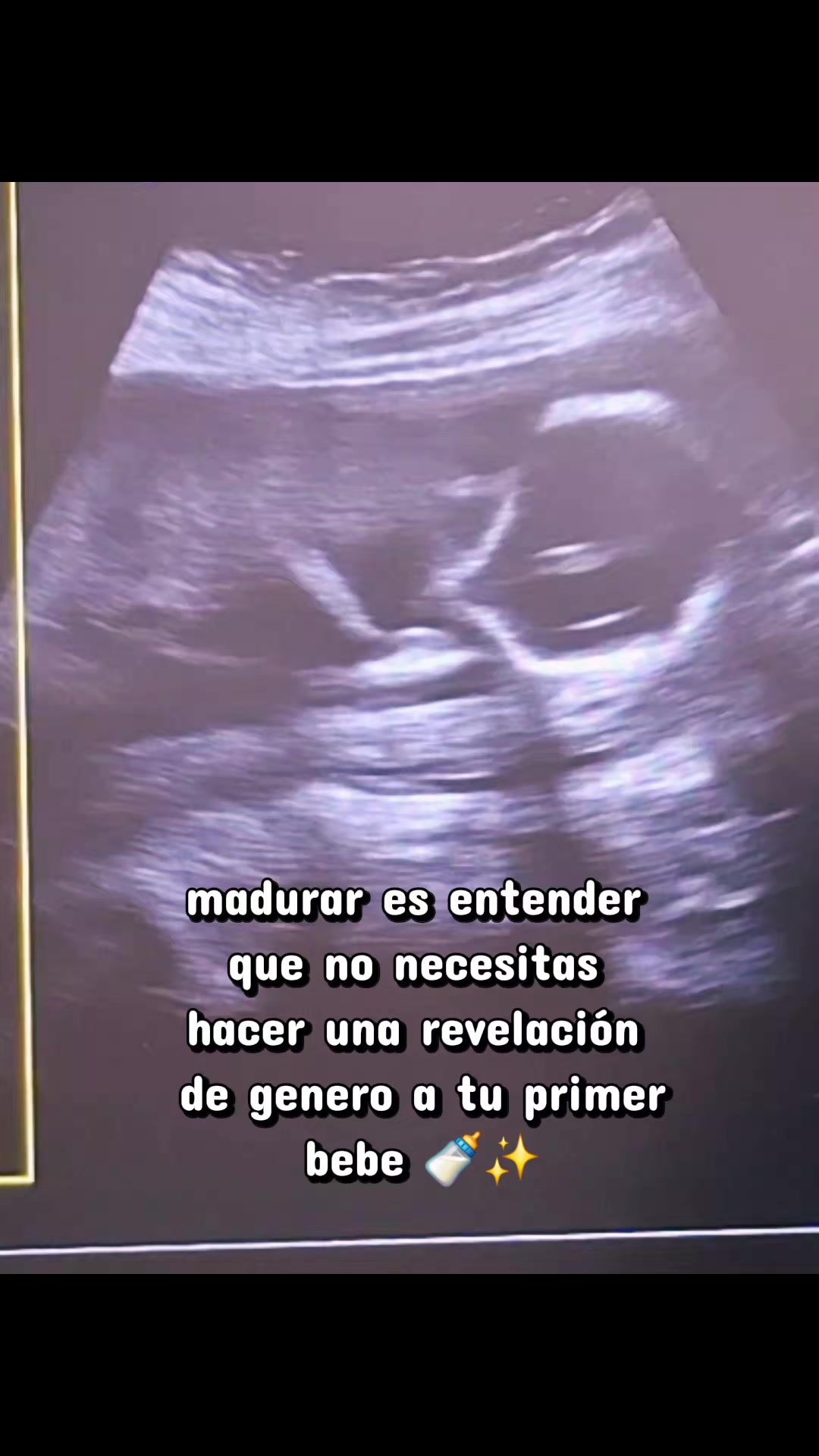 @Liza Ximena