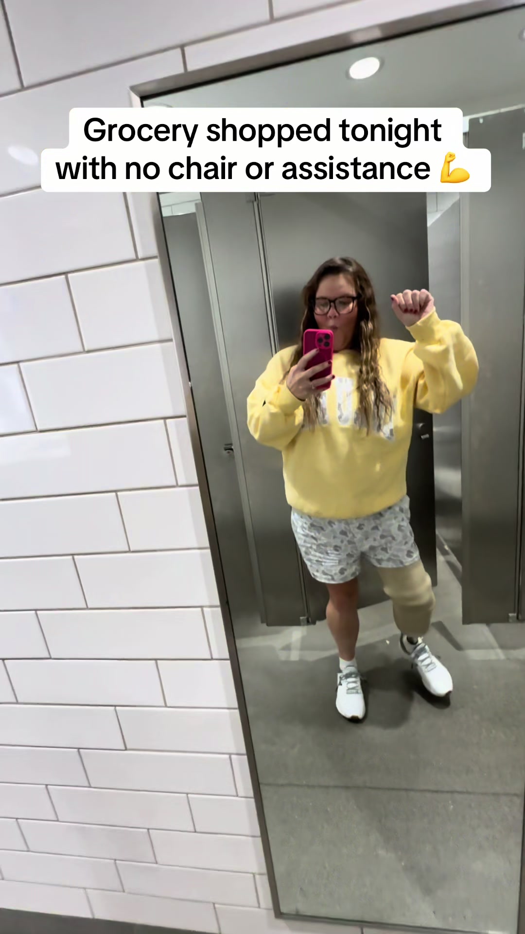 @Nikki | One Leg, Full Life 🦿