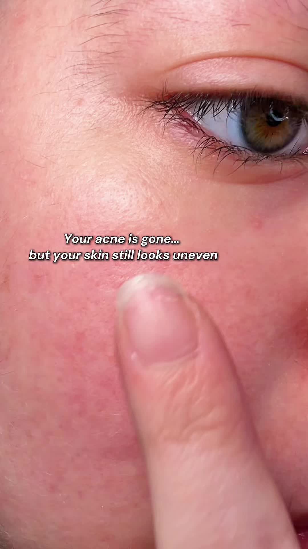 @Katie | Olive Skin + Beauty