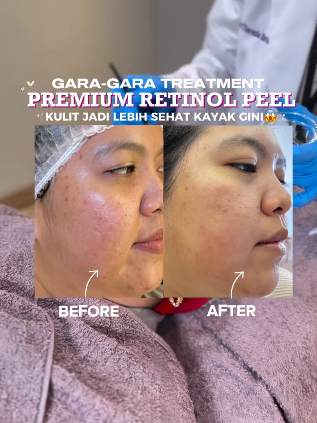 @Leny Skincare Karawaci