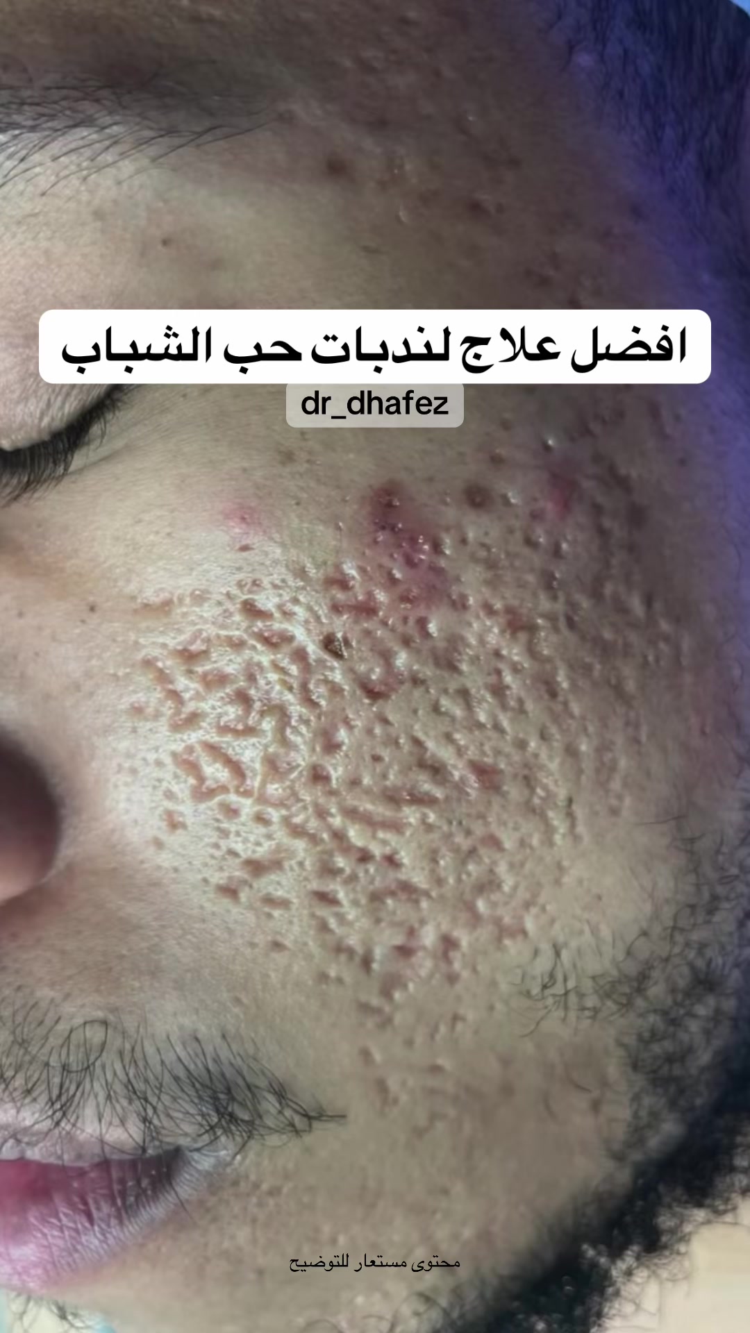 @د. ظافر آل حافظ