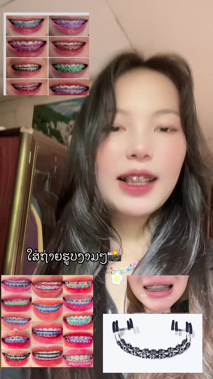 @ເພຈ.ແມ່ຄ້າຂາຍເຫລັກດັດຟັນ✨🛍️