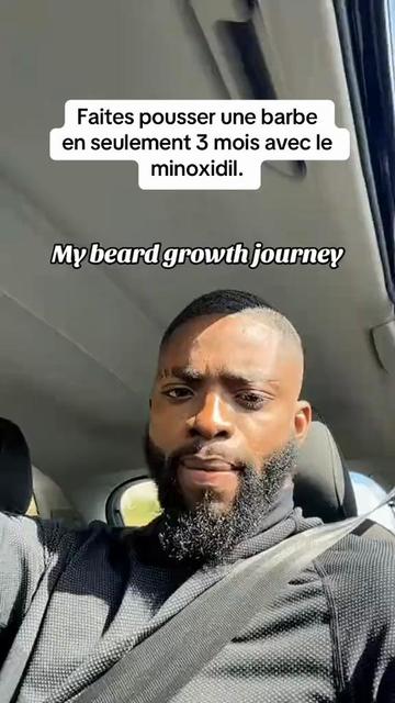 @Minoxidil DR Congo