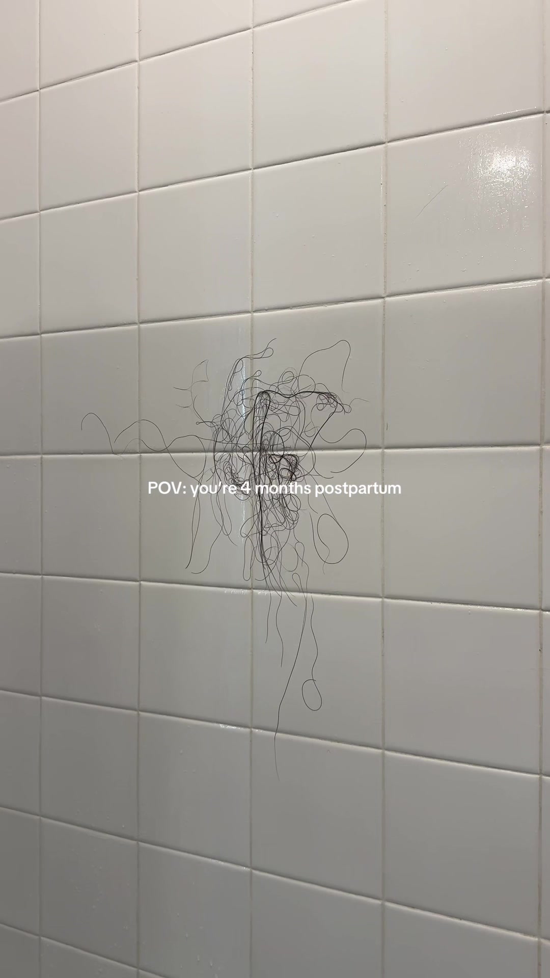 @zoe | FTM 🤍 IVF success