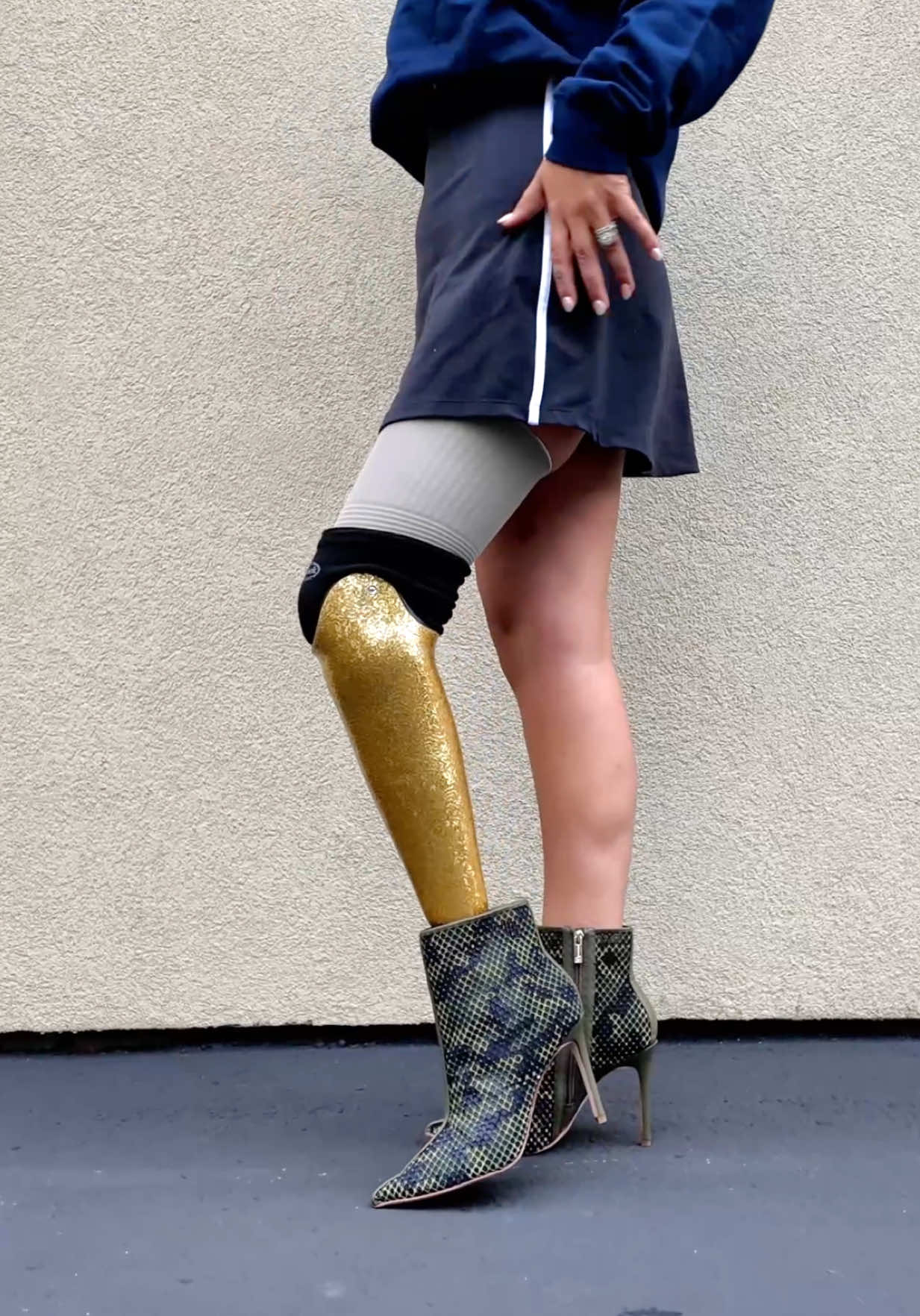 @A Step Ahead Prosthetics