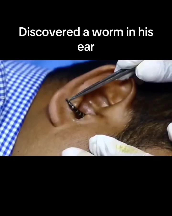 @Satisfying Ear Cleaning Videos