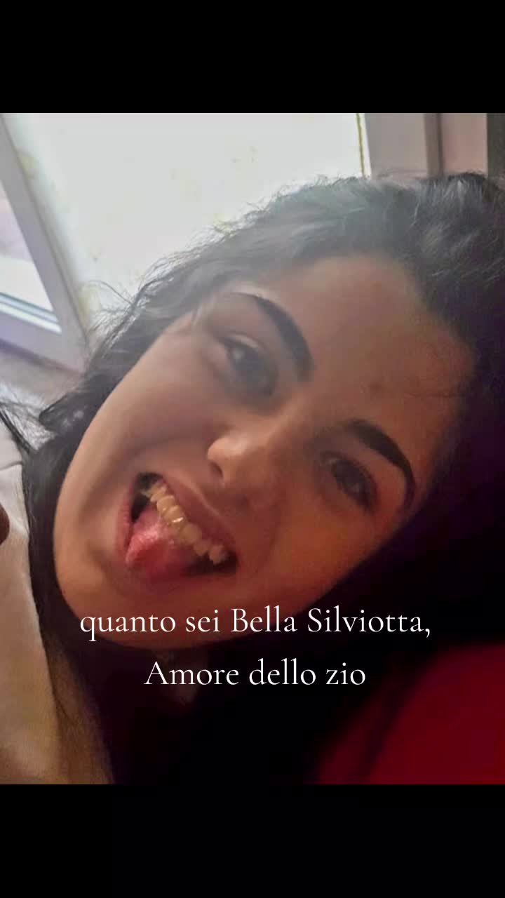 @La giusta distanza tra I ricci