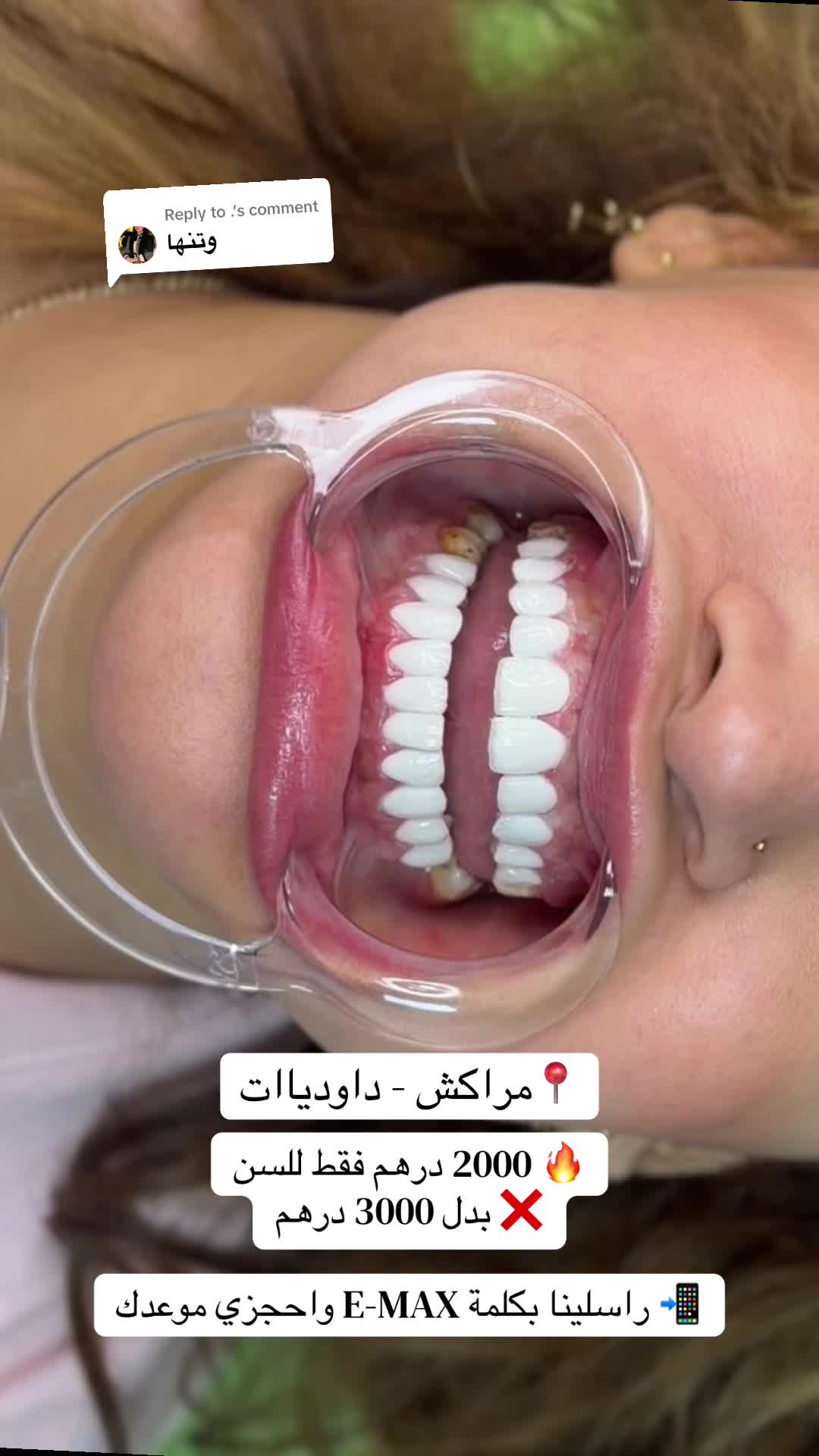@brightsmileee1