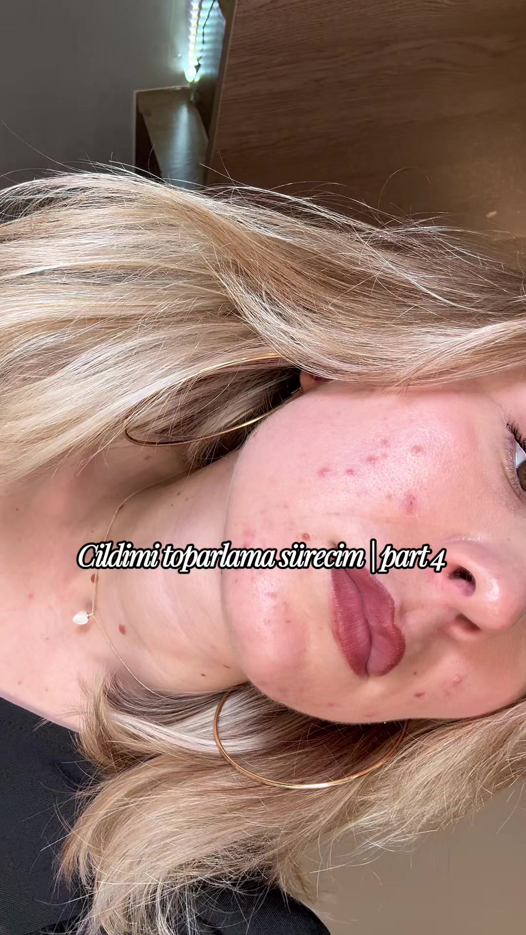 @&Uuml;mran Demir