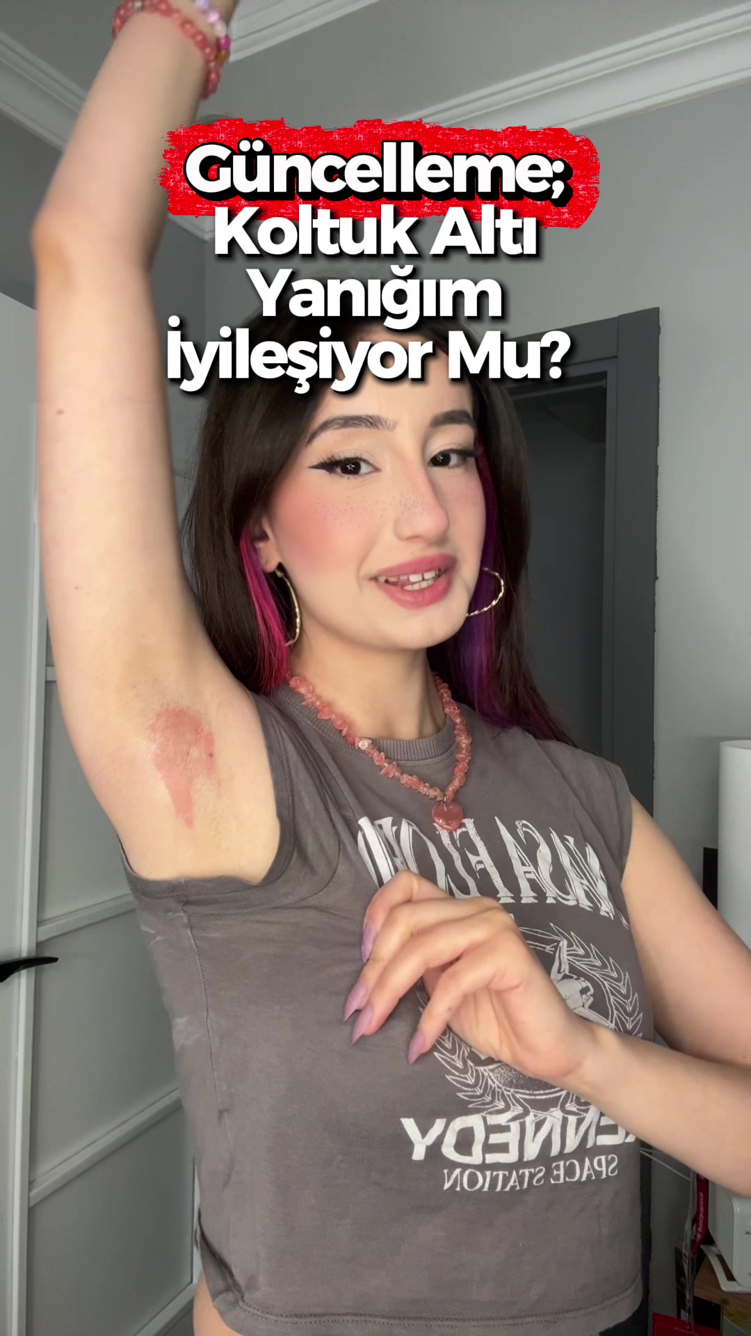 @Elifsu Durmaz
