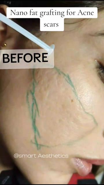 @Dr Ihsan Hair Transplant