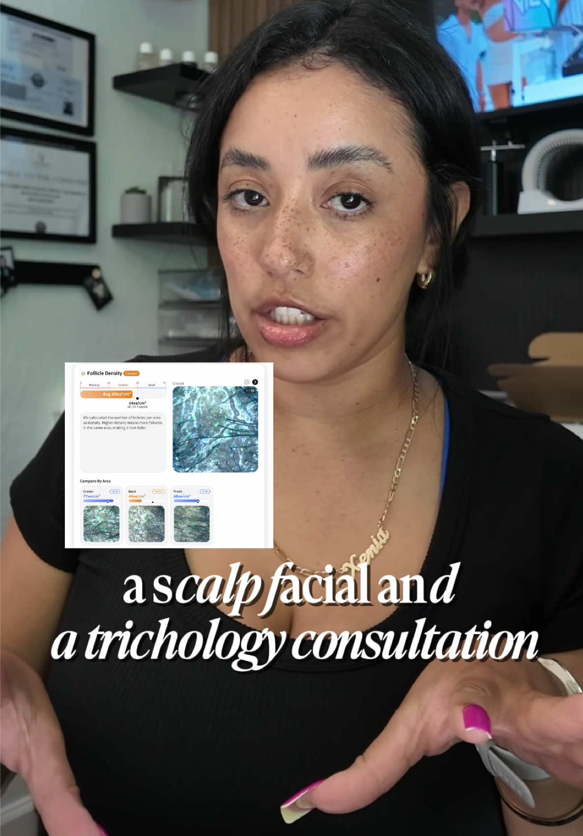 @Xenia Maritza | Trichologist