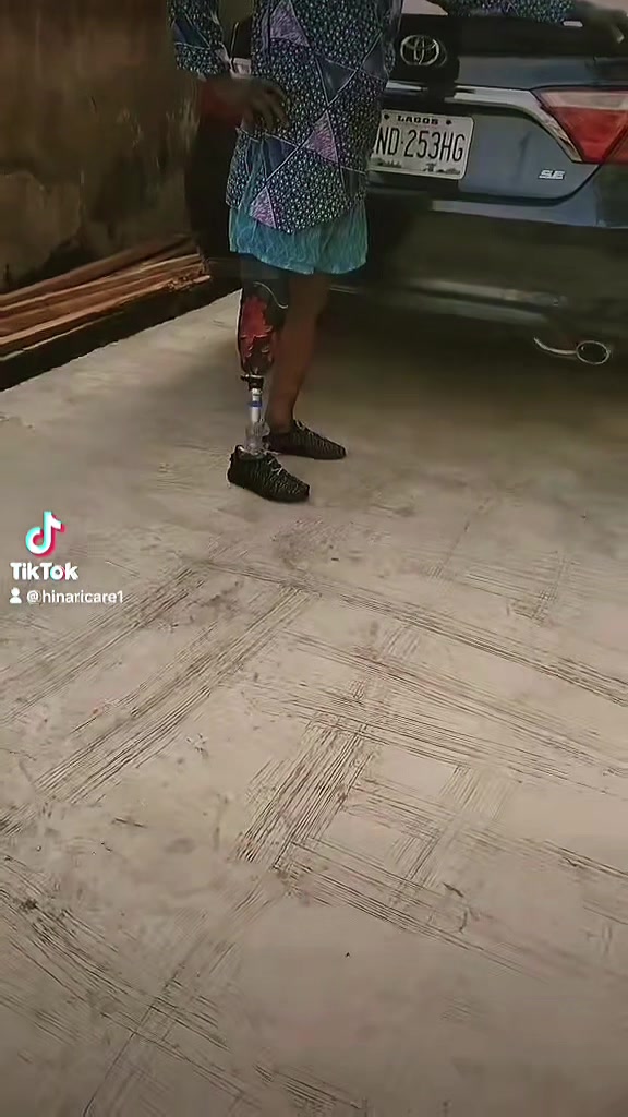 @Hinaricare prosthetics