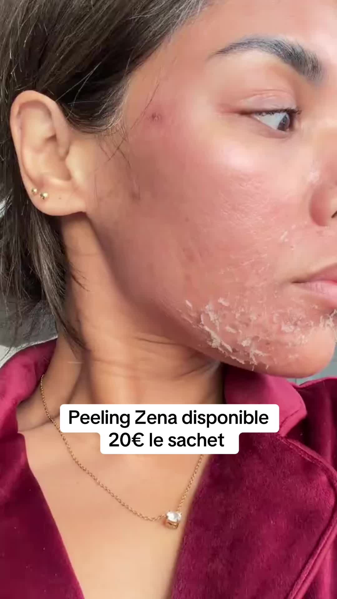 @peeling_zena