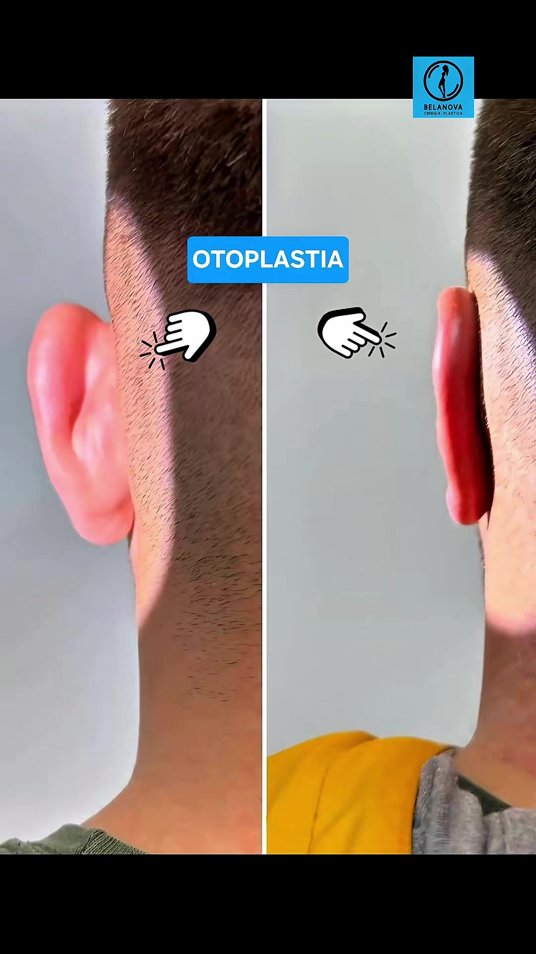@Belanovacirugiaplastica