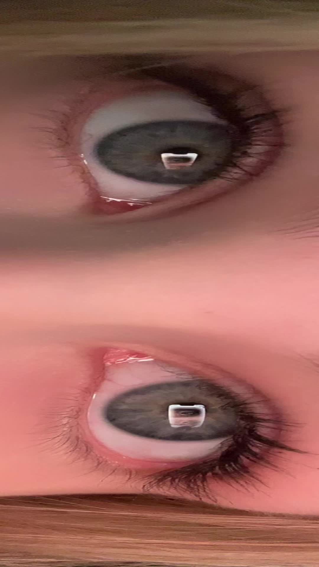 @†