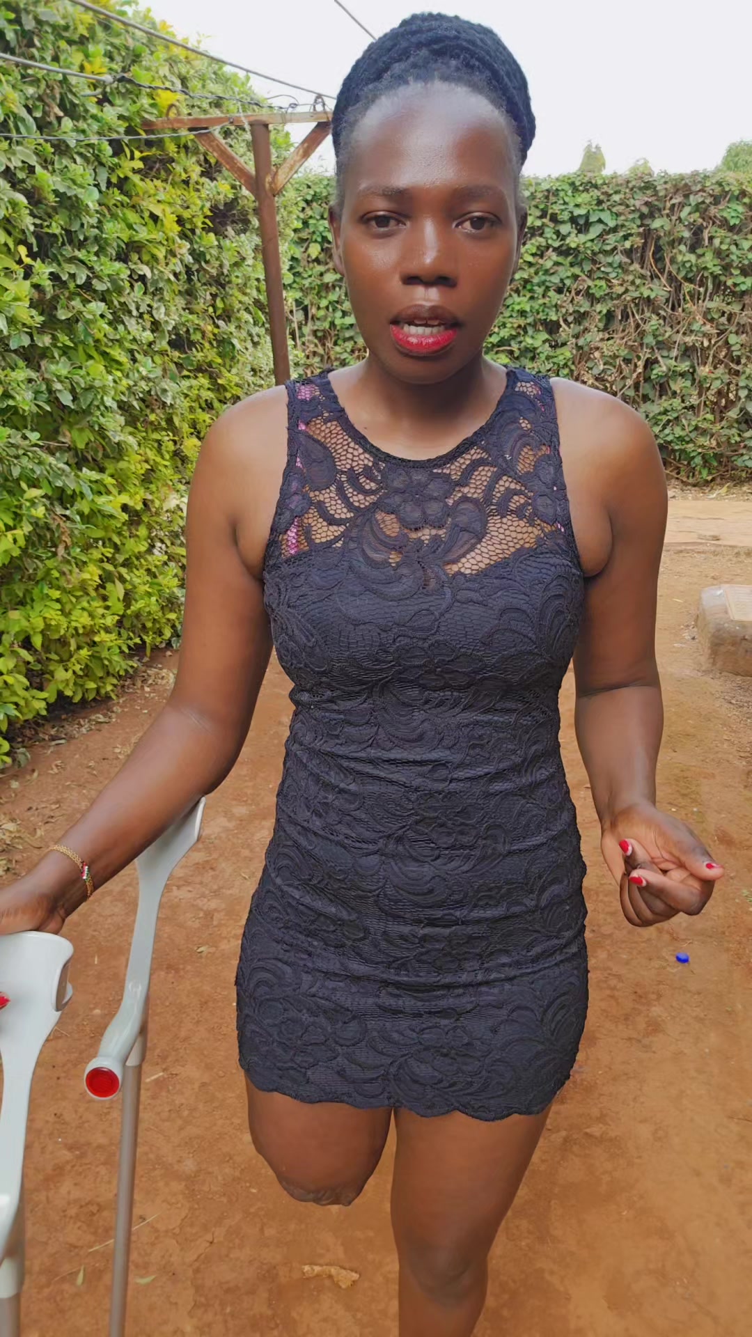 @💎Nattie Amputee🇰🇪♊️
