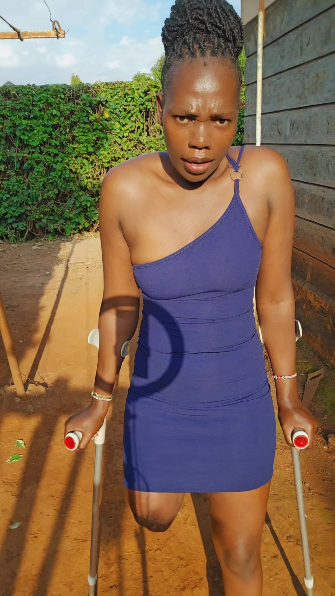 @💎Nattie Amputee🇰🇪♊️