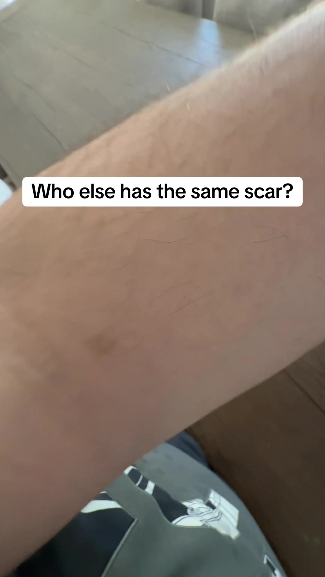@v12doc