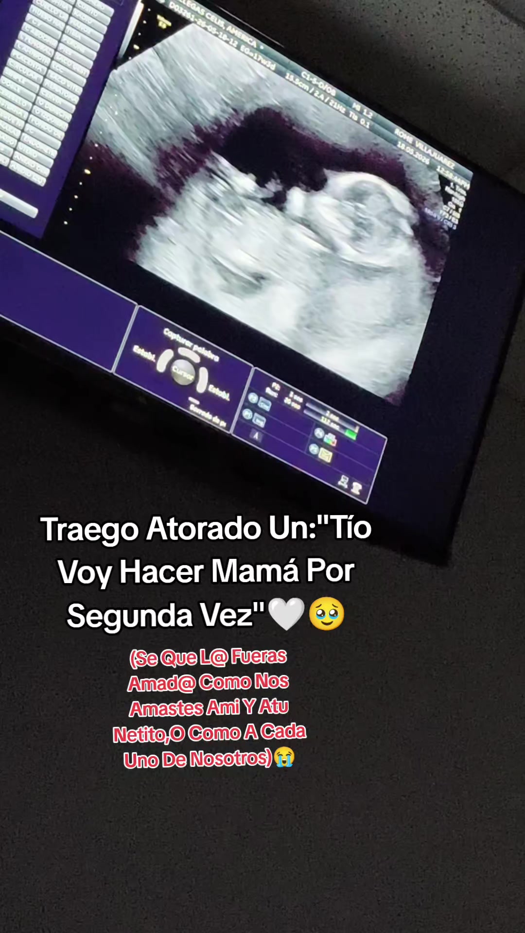 @Ameriica Viillegas