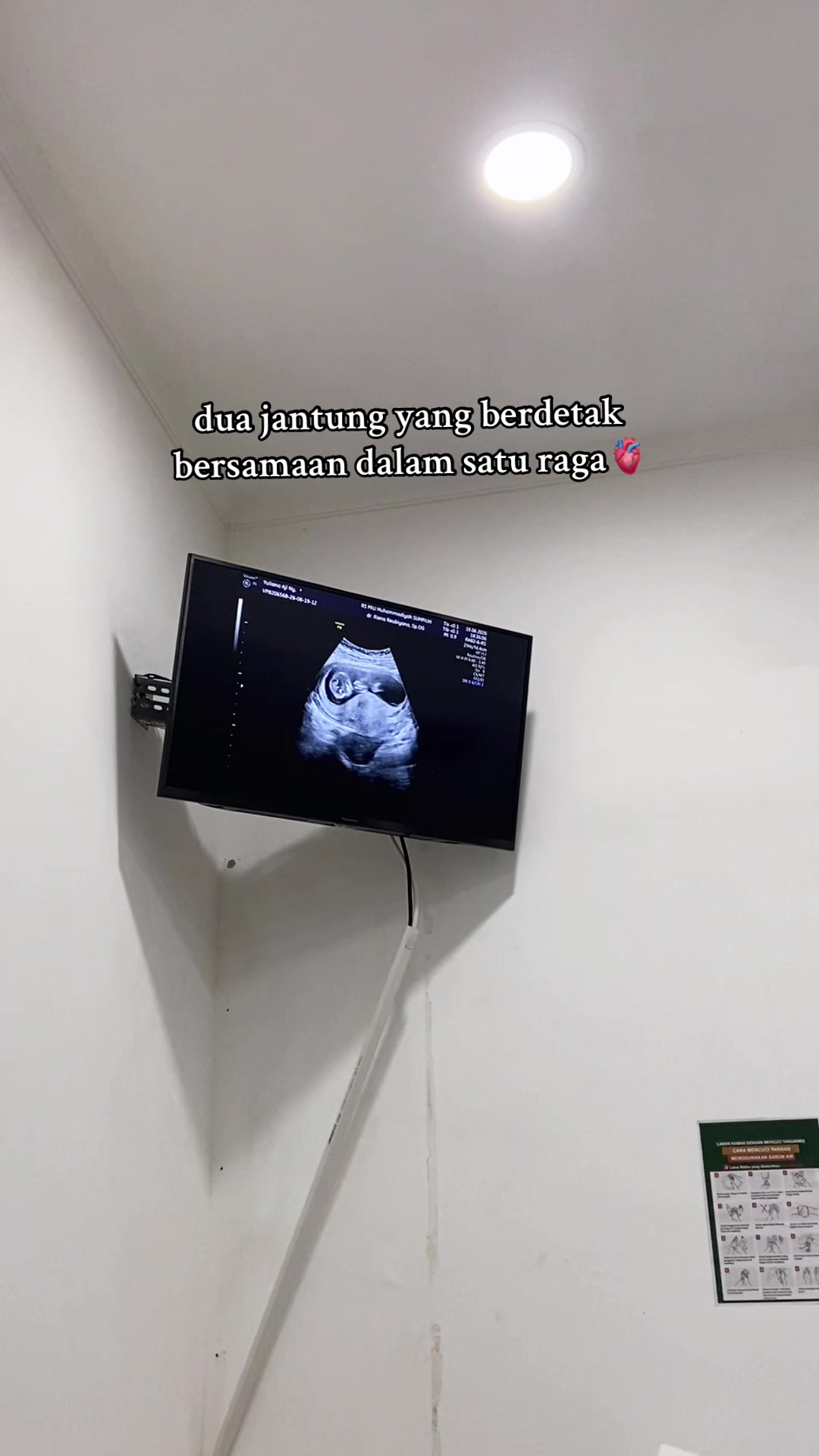 @YulianaLarasati