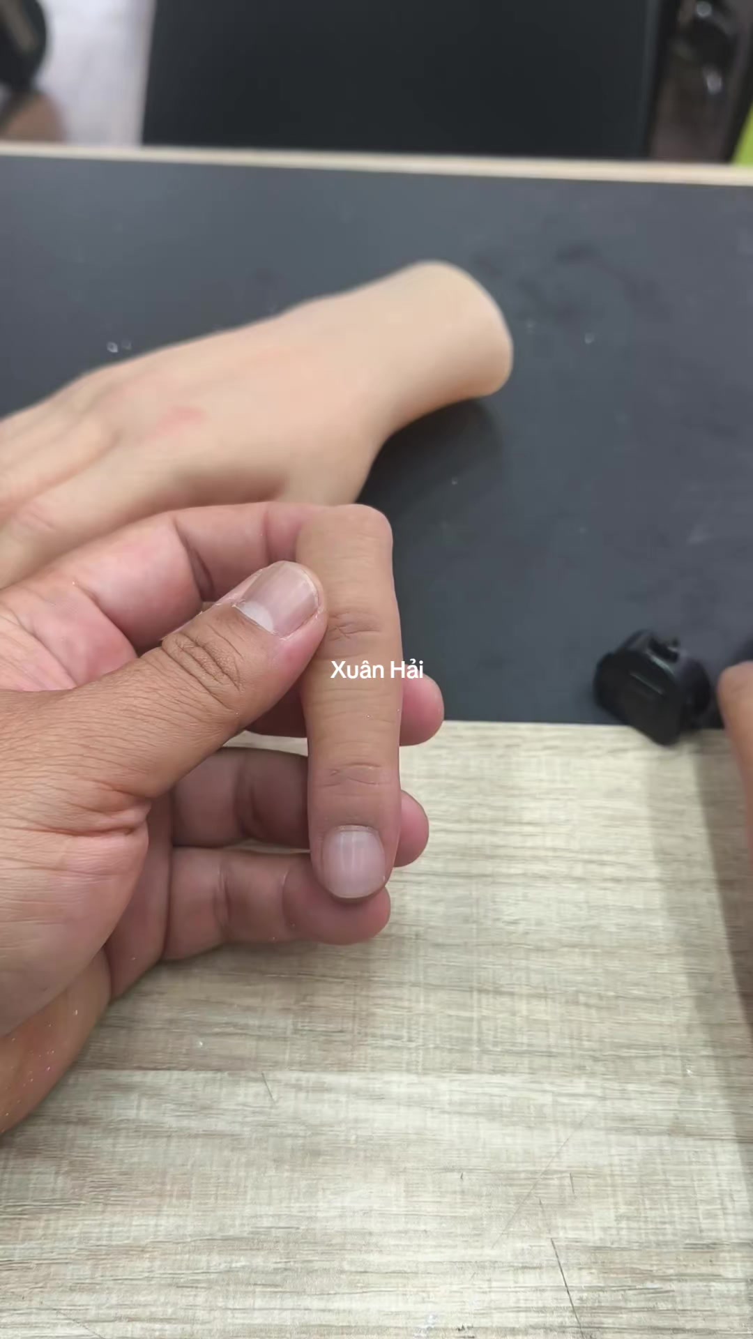 @Hải R&acirc;u Tay Ch&acirc;n Giả
