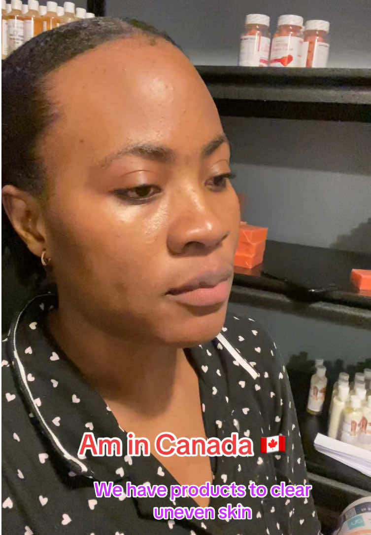 @Cherryglowb🇨🇦🇺🇸🇨🇳🇨🇲