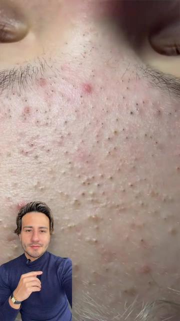 @chrisantiage