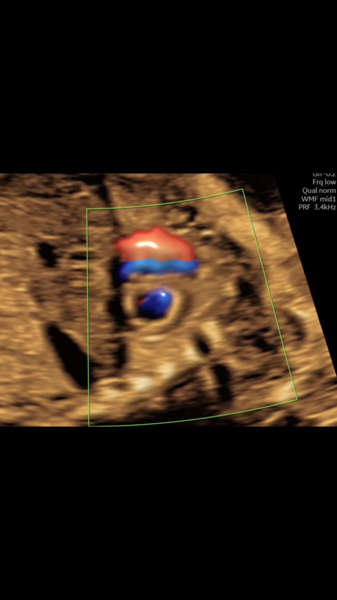 @Sonoeyes Ultrasound